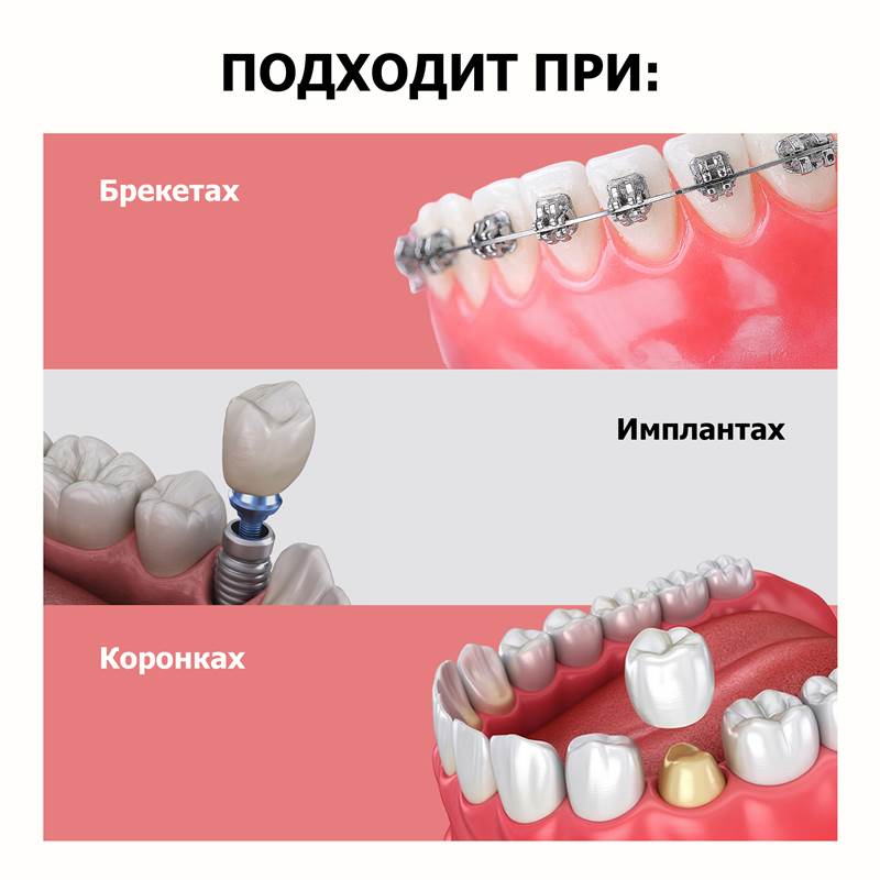 5b0b9139-f2af-11f0-84b8-00d8617040a4-purshatcosmyoshk_8