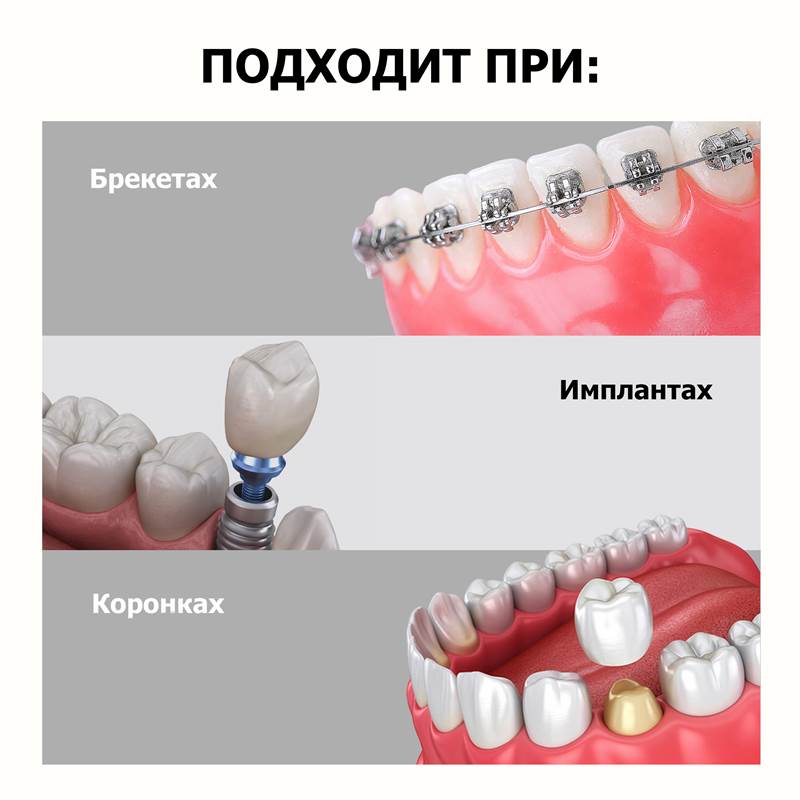 6c50d9a2-f2af-11f0-84b8-00d8617040a4-purshatcosmyoshk_8