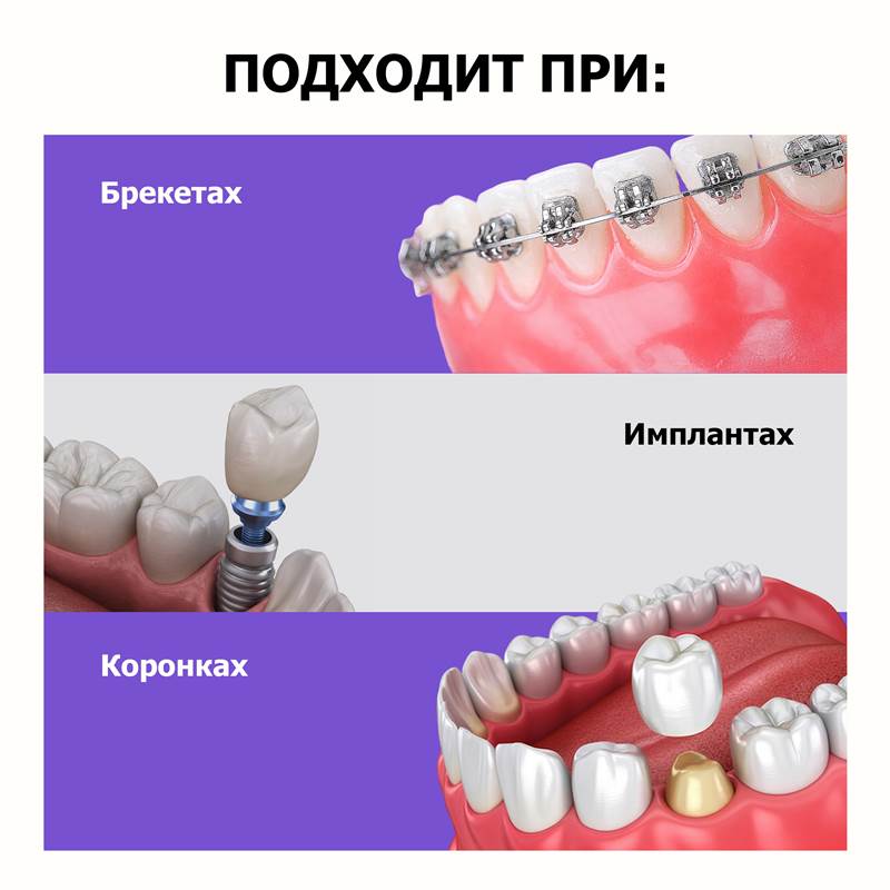 48e67739-f2af-11f0-84b8-00d8617040a4-purshatcosmyoshk_8